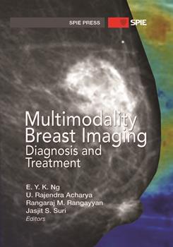 Multimodality Breast Imaging: Diagnosis and Treatment